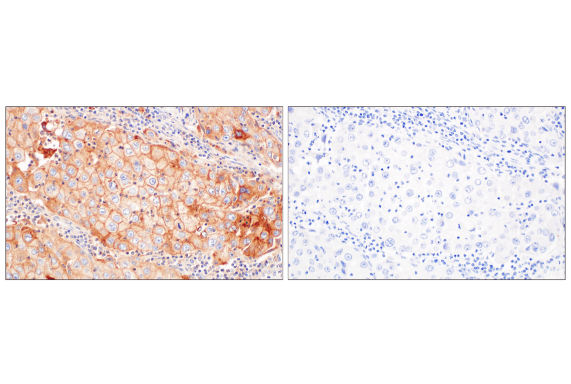 Immunohistochemistry Image 11: LY6E (F8Y1R) Rabbit Monoclonal Antibody