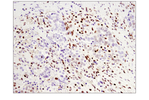 Immunohistochemistry Image 4: SLFN11 (D8W1B) Rabbit Monoclonal Antibody