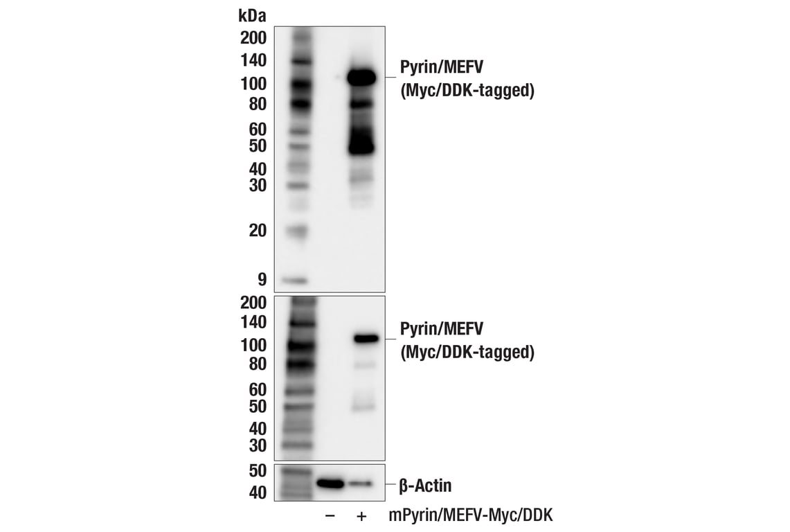 Western Blotting Image 2: Pyrin/MEFV (F9C4G) Rabbit Monoclonal Antibody