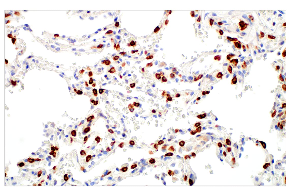 Immunohistochemistry Image 5: LPCAT1 (E4V4B) Rabbit Monoclonal Antibody (BSA and Azide Free)