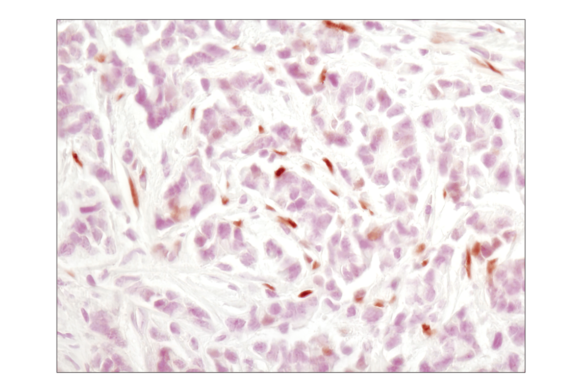 Immunohistochemistry Image 1: Phospho-Stat3 (Tyr705) (M9C6) Mouse Monoclonal Antibody