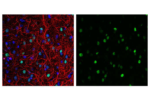 Immunofluorescence Image 1: c-Fos (9F6) Rabbit Monoclonal Antibody (BSA and Azide Free)