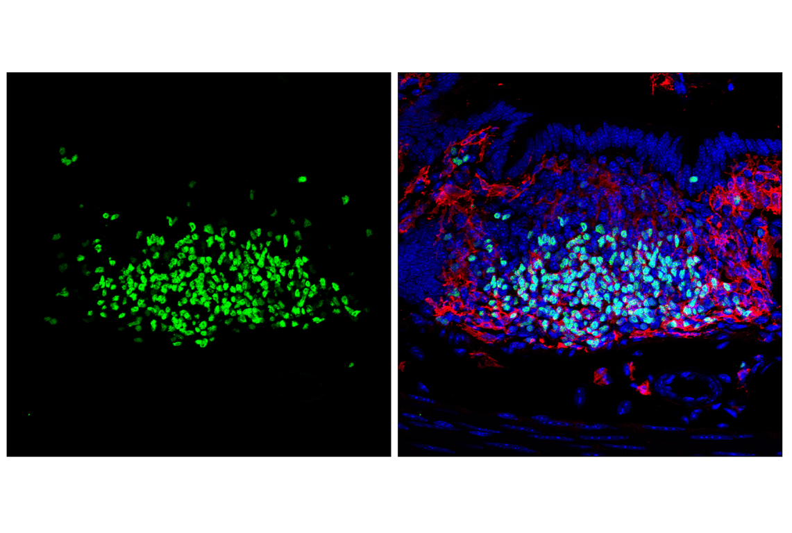 Immunofluorescence Image 2: Aiolos (D1C1E) Rabbit Monoclonal Antibody
