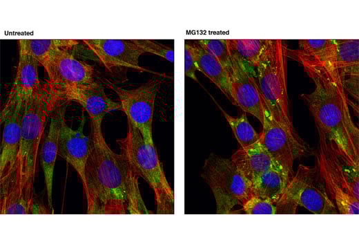 Immunofluorescence Image 1: FMRP Antibody