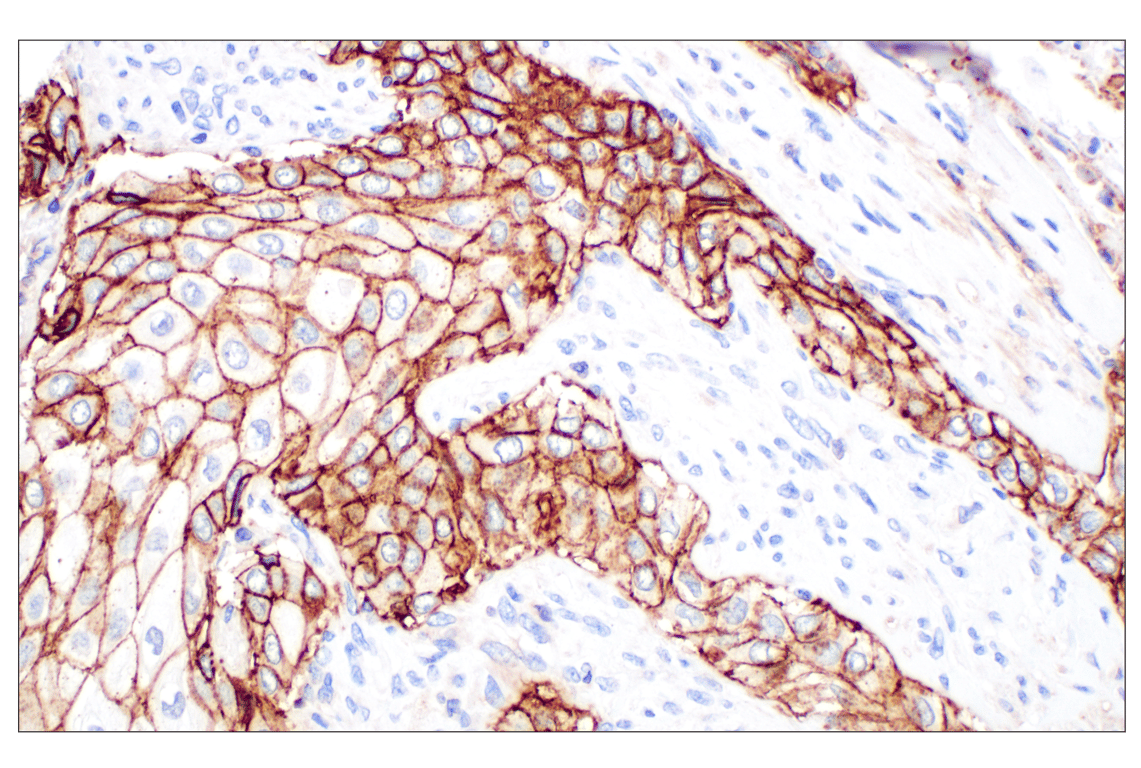 Immunohistochemistry Image 2: CD44 v5 (C44Mab-3) Mouse Monoclonal Antibody