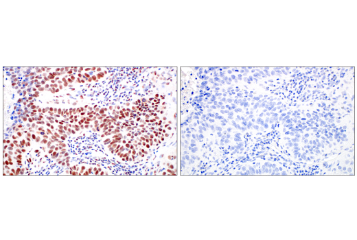 undefined Image 40: ATM Substrates Antibody Sampler Kit