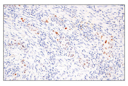 Immunohistochemistry Image 2: p14 ARF (E3X6D) Rabbit Monoclonal Antibody (BSA and Azide Free)