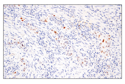 Immunohistochemistry Image 2: p14 ARF (E3X6D) Rabbit mAb (BSA and Azide Free)