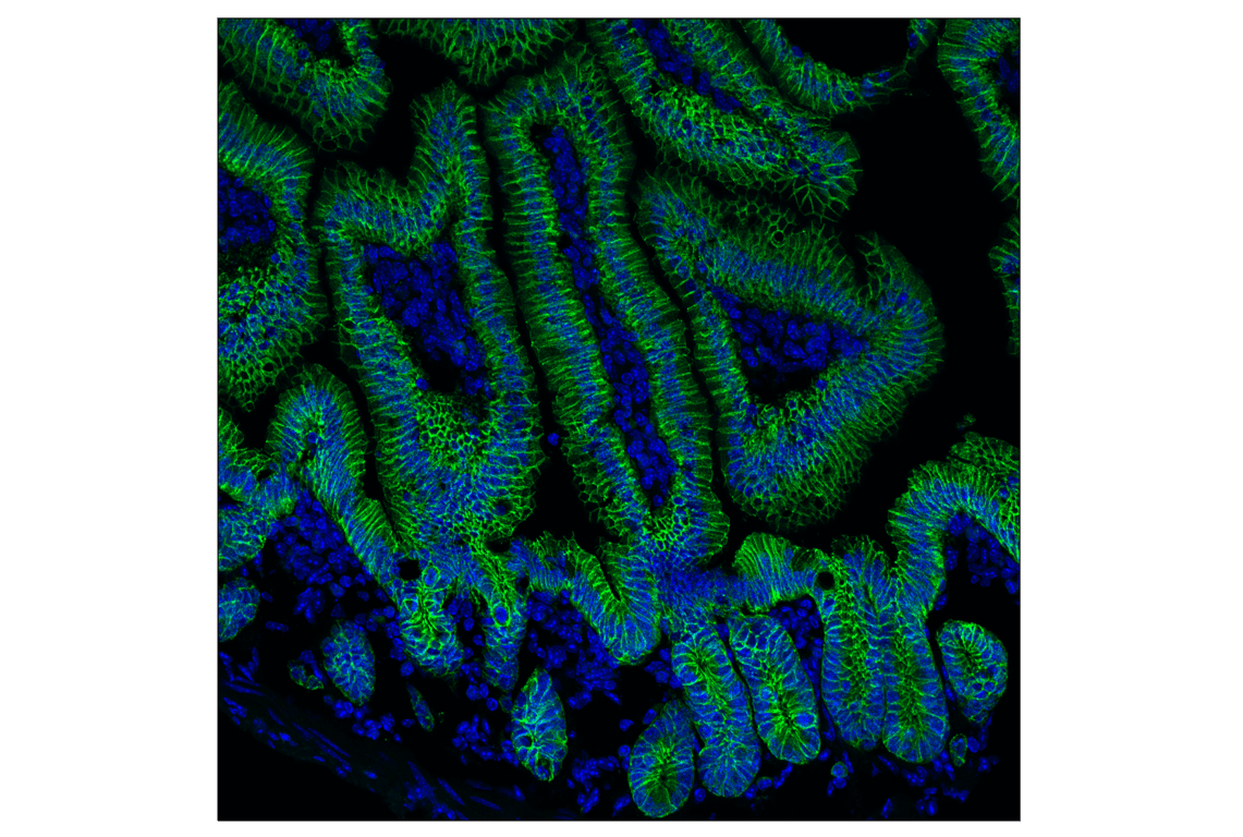 Immunofluorescence Image 1: E-Cadherin (24E10) Rabbit Monoclonal Antibody