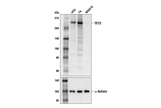 Western Blotting Image 1: TET2 (D6C7K) Rabbit mAb