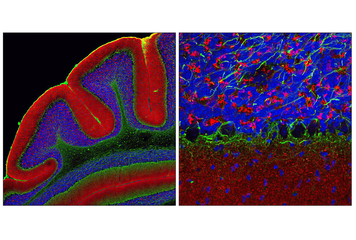 Immunofluorescence Image 2: Anti-rabbit IgG (H+L), F(ab')<sub>2</sub> Fragment (Alexa Fluor<sup>®</sup> 555 Conjugate)