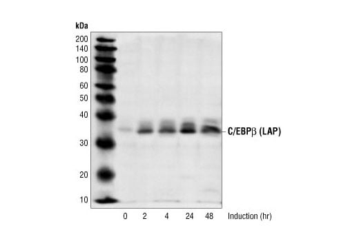 Western Blotting Image 2: C/EBP beta (LAP) Antibody