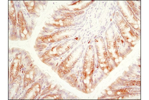 Immunohistochemistry Image 3: Phospho-S6 Ribosomal Protein (Ser240/244) (D68F8) Rabbit Monoclonal Antibody