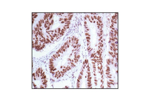 Immunohistochemistry Image 2: Phospho-MAPK/CDK Substrates (PXS*P or S*PXR/K) (34B2) Rabbit Monoclonal Antibody