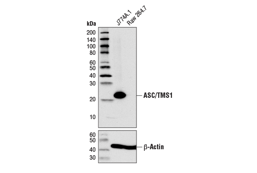 Western Blotting Image 1: ASC/TMS1 (D2W8U) Rabbit mAb