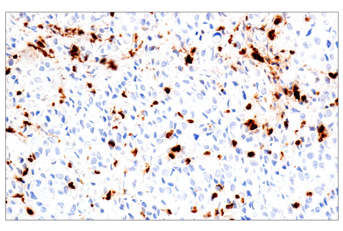 Immunohistochemistry Image 1: Eosinophil cationic protein (E6U5M) Rabbit Monoclonal Antibody (BSA and Azide Free)