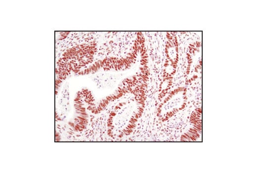Immunohistochemistry Image 2: CTCF (D31H2) Rabbit Monoclonal Antibody