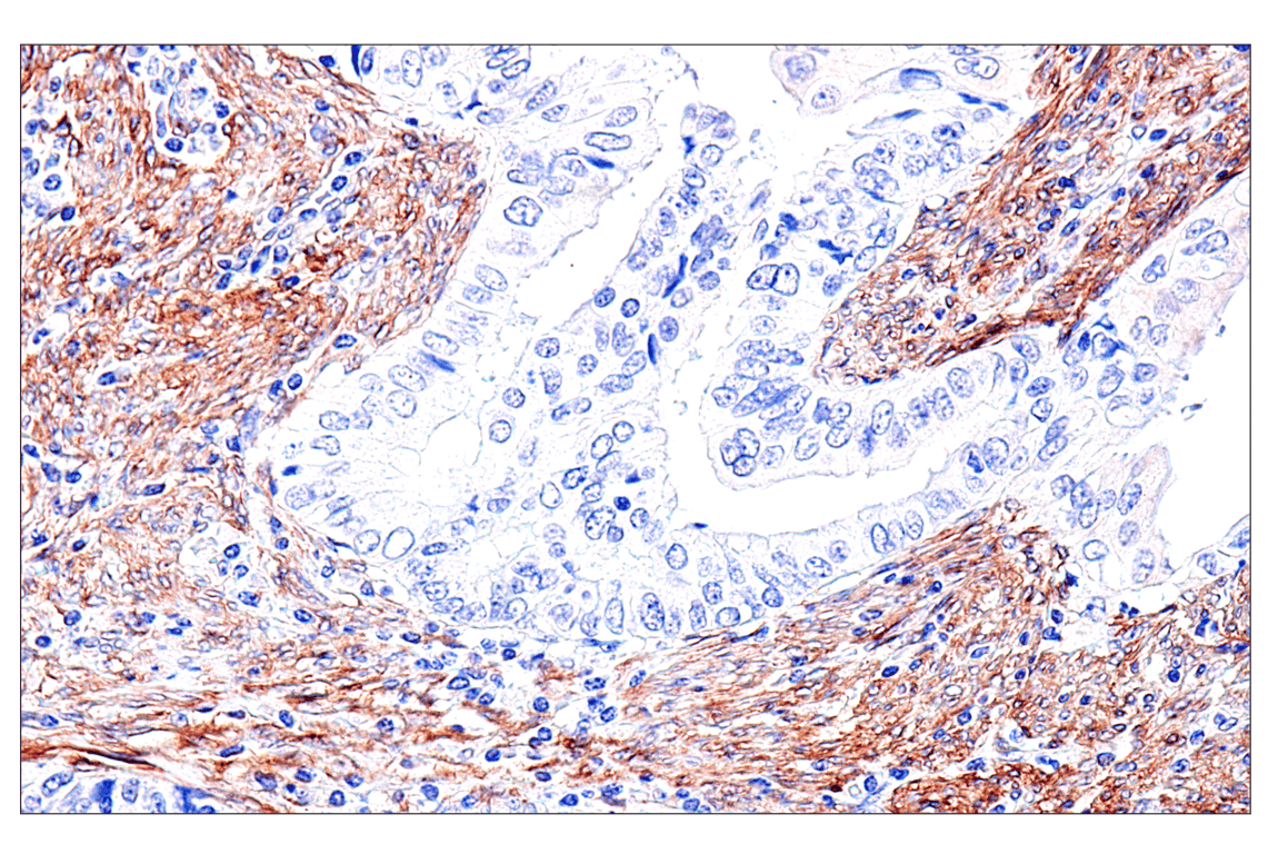 Immunohistochemistry Image 14: FAP (F1A4G) Rabbit Monoclonal Antibody
