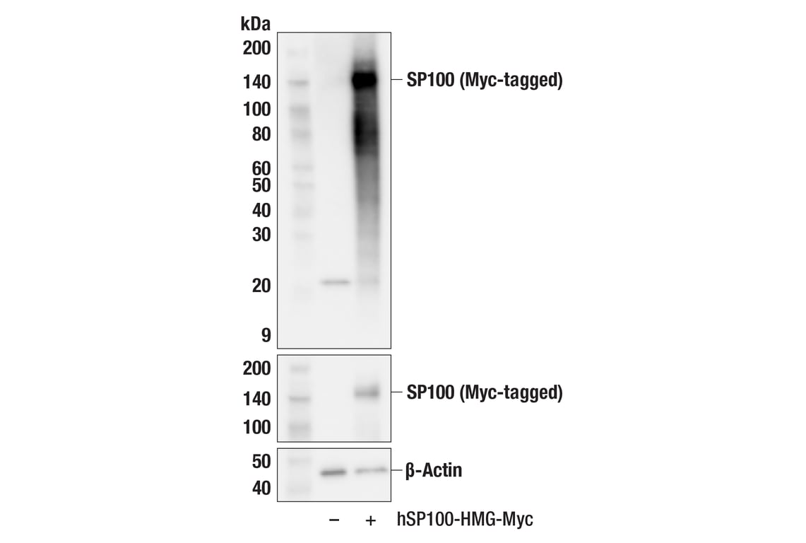 Western Blotting Image 2: SP100 (F1H6X) Rabbit Monoclonal Antibody