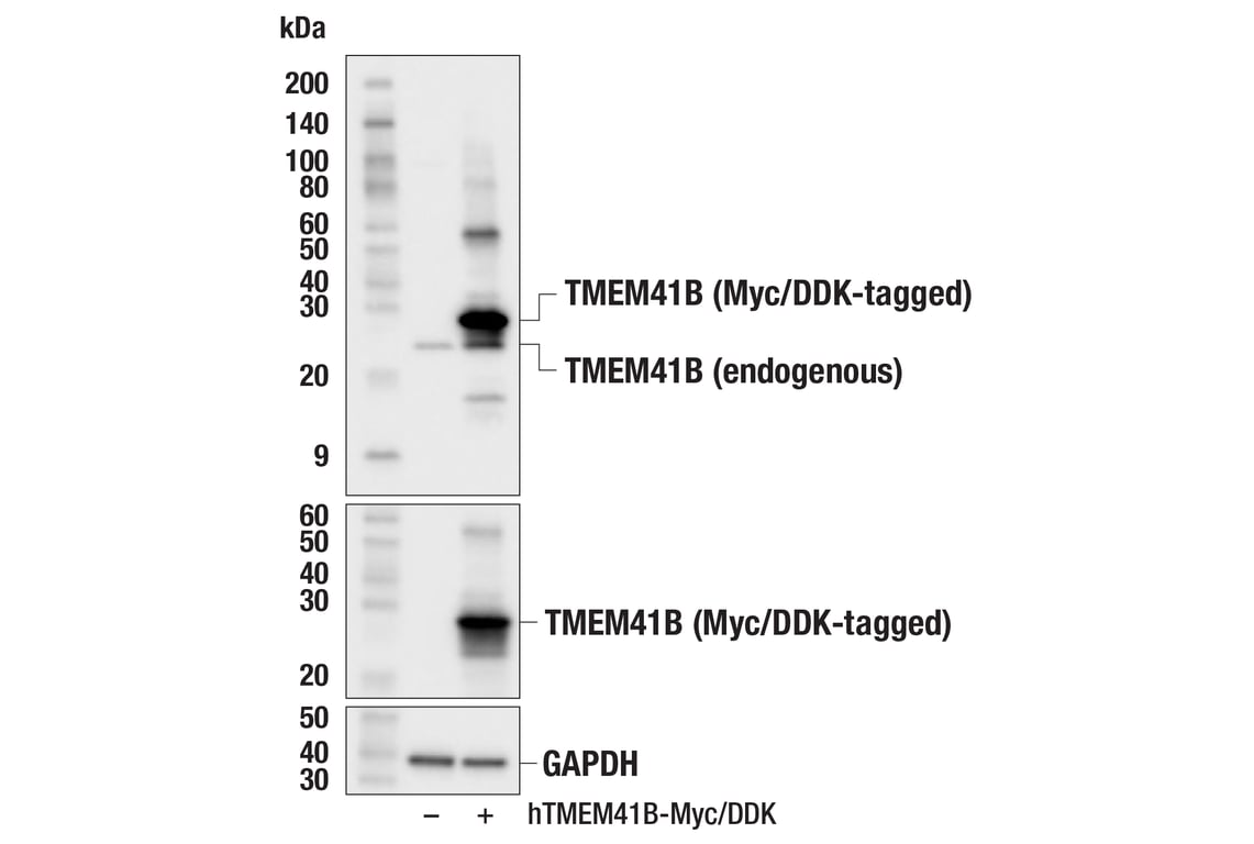 Western Blotting Image 2: TMEM41B (F6F4Z) Rabbit Monoclonal Antibody