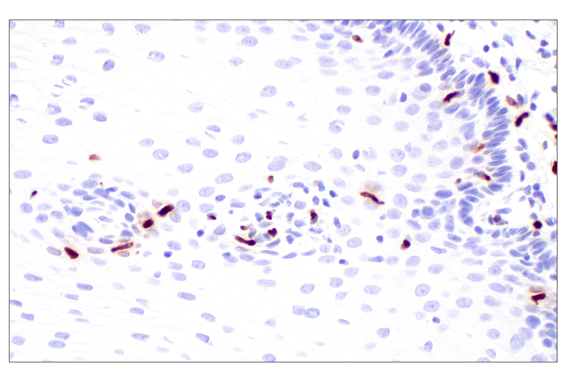 Immunohistochemistry Image 7: MNDA (3C1) Rat Monoclonal Antibody
