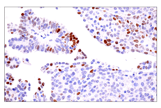 Immunohistochemistry Image 4: Phospho-Chk2 (Thr68) (E8Q1A) Rabbit Monoclonal Antibody (BSA and Azide Free)
