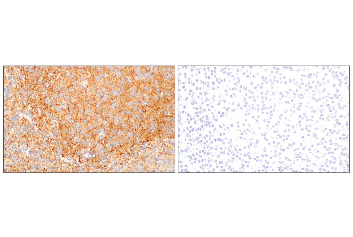 Immunohistochemistry Image 6: Doublecortin (E3S7L) Rabbit Monoclonal Antibody