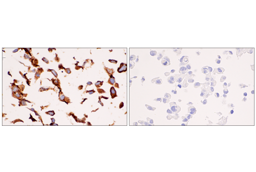Immunohistochemistry Image 4: COL5A1 (E6U9W) Rabbit Monoclonal Antibody (BSA and Azide Free)