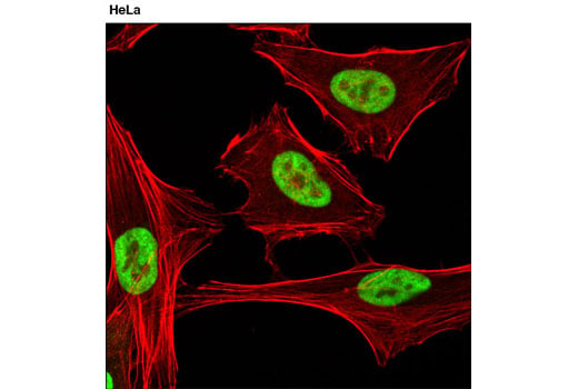 Immunofluorescence Image 1: hnRNP A0 (D8A3) XP<sup>®</sup> Rabbit mAb