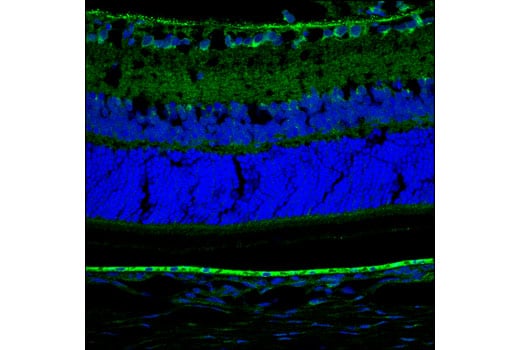 Immunofluorescence Image 1: CLCN3 (D8Y5Q) Rabbit Monoclonal Antibody