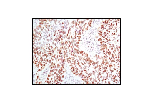 Immunohistochemistry Image 3: MCM2 (D7G11) Rabbit Monoclonal Antibody (BSA and Azide Free)