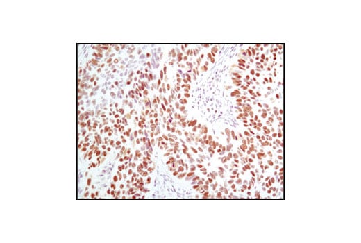 Immunohistochemistry Image 3: MCM2 (D7G11) XP<sup>®</sup> Rabbit mAb (BSA and Azide Free)