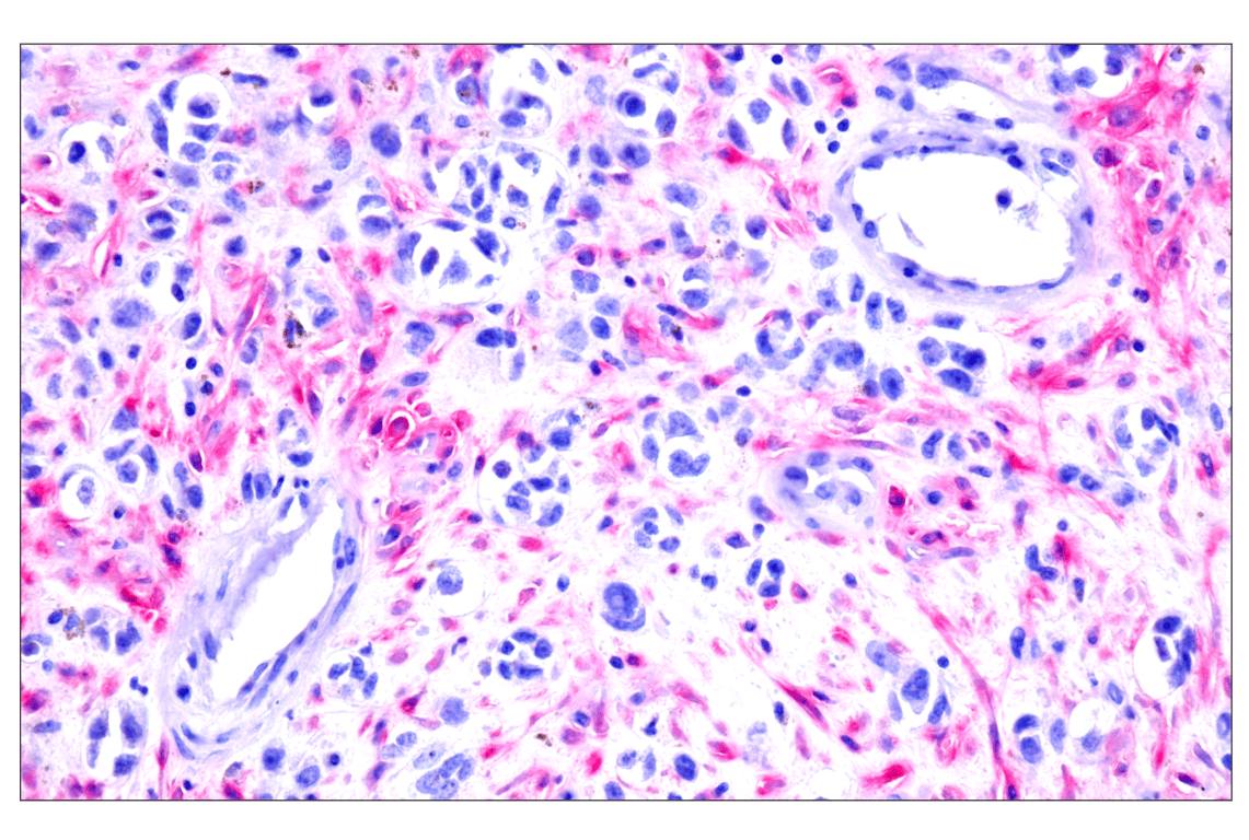 Immunohistochemistry Image 13: FAP (F1A4G) Rabbit mAb