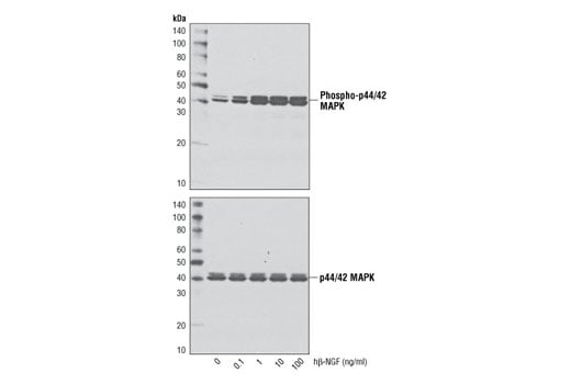 undefined Image 3: Human β-Nerve Growth Factor (hβ-NGF)