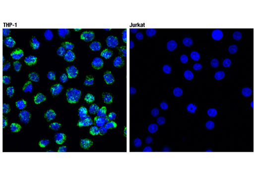 CD68 (D4B9C) XP® Rabbit mAb | Cell Signaling Technology