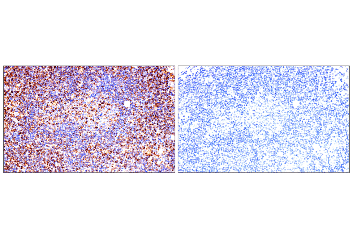 Immunohistochemistry Image 13: TSPO (F5B8F) Rabbit Monoclonal Antibody