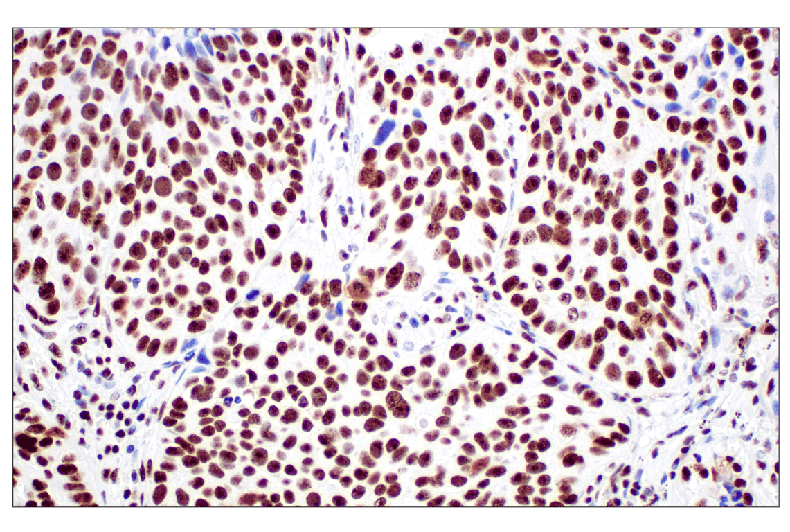 Immunohistochemistry Image 1: NPM1 (E7W4P) Rabbit Monoclonal Antibody (BSA and Azide Free)