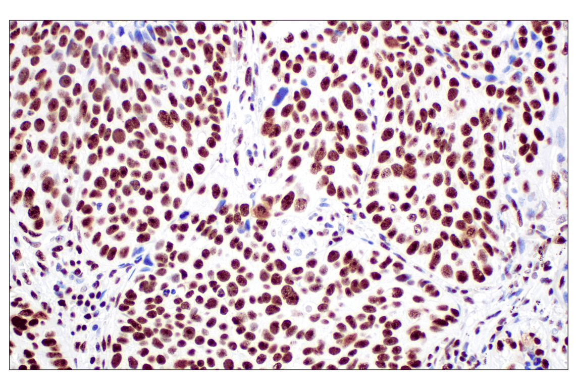Immunohistochemistry Image 1: NPM1 (E7W4P) Rabbit mAb (BSA and Azide Free)