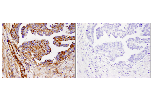 Immunohistochemistry Image 3: B7-H3 (D9M2L) Rabbit Monoclonal Antibody (BSA and Azide Free)