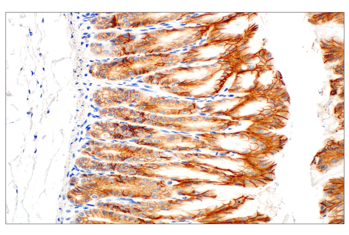 Immunohistochemistry Image 7: E-Cadherin (24E10) Rabbit Monoclonal Antibody (BSA and Azide Free)