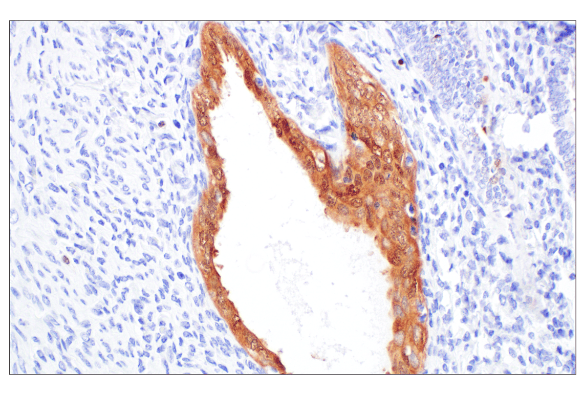 Immunohistochemistry Image 7: p16 INK4A (F9T1L) Rabbit Monoclonal Antibody