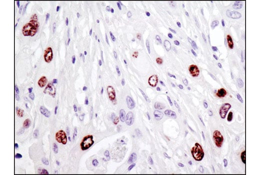 Immunohistochemistry Image 1: HMGA2 (D1A7) Rabbit Monoclonal Antibody