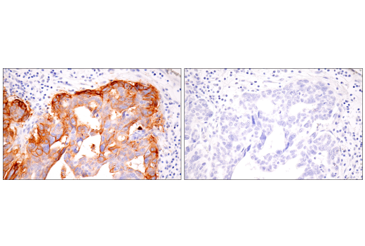Immunohistochemistry Image 2: Claudin-6 (E7U2O) XP<sup>®</sup> Rabbit mAb (BSA and Azide Free)