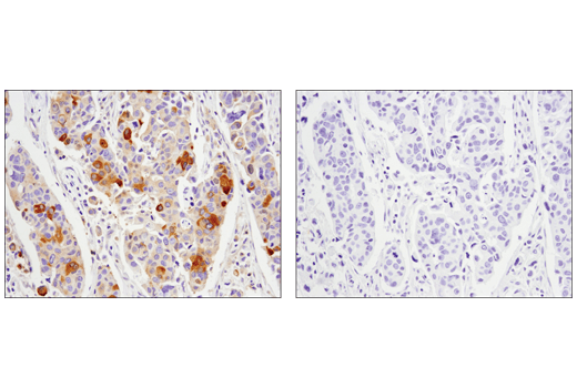 Immunohistochemistry Image 1: Phospho-Glycogen Synthase (Ser641) (D4H1B) Rabbit Monoclonal Antibody