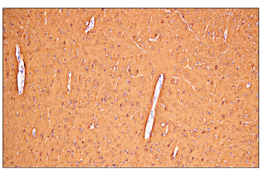 Immunohistochemistry Image 5: Enolase-2 (E2H9X) Rabbit Monoclonal Antibody