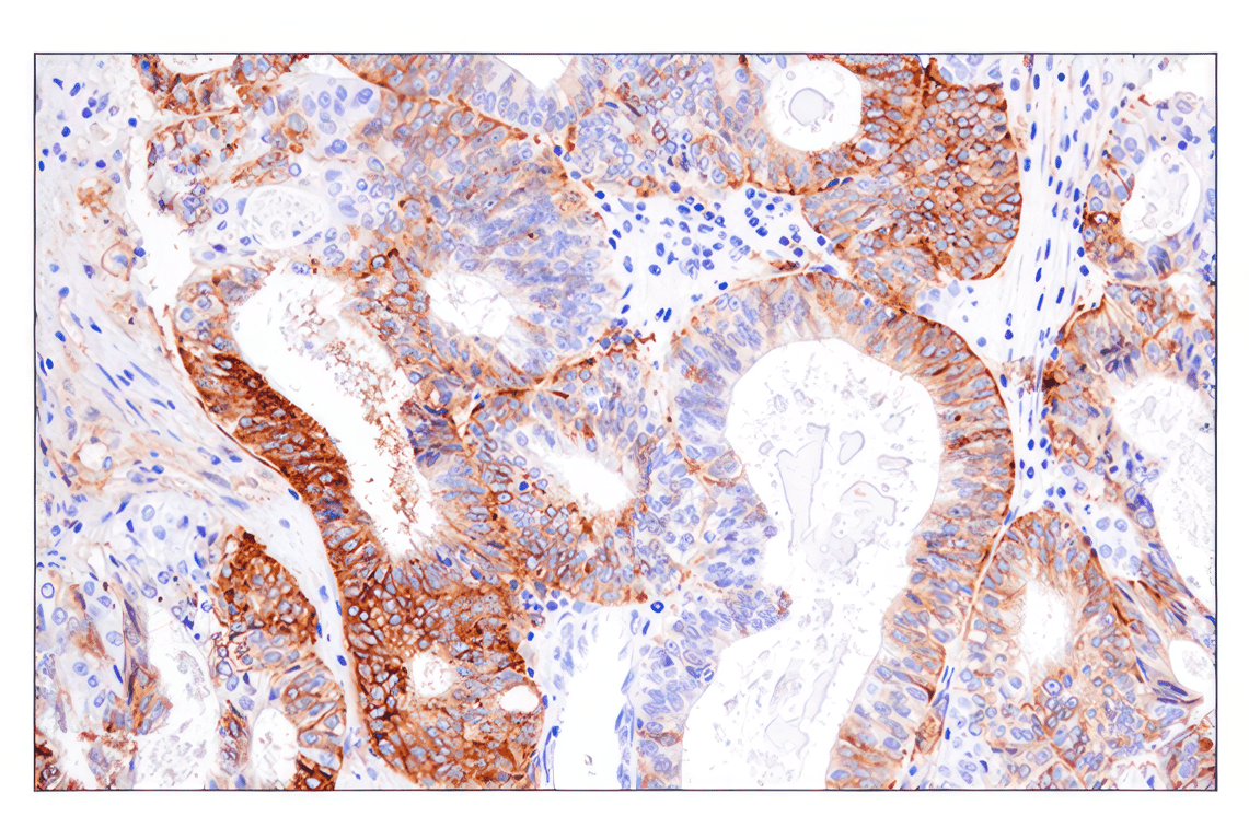 Immunohistochemistry Image 2: HLA-DRA (E9R2Q) Rabbit Monoclonal Antibody