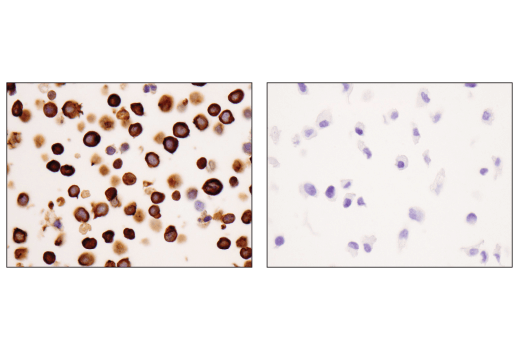 Immunohistochemistry Image 2: Coronin 1A (D6K5B) Rabbit Monoclonal Antibody