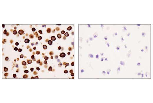 Immunohistochemistry Image 2: Coronin 1A (D6K5B) XP<sup>®</sup> Rabbit mAb