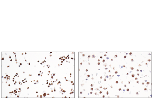 Immunohistochemistry Image 5: JMJD6 (D3O3N) Rabbit Monoclonal Antibody