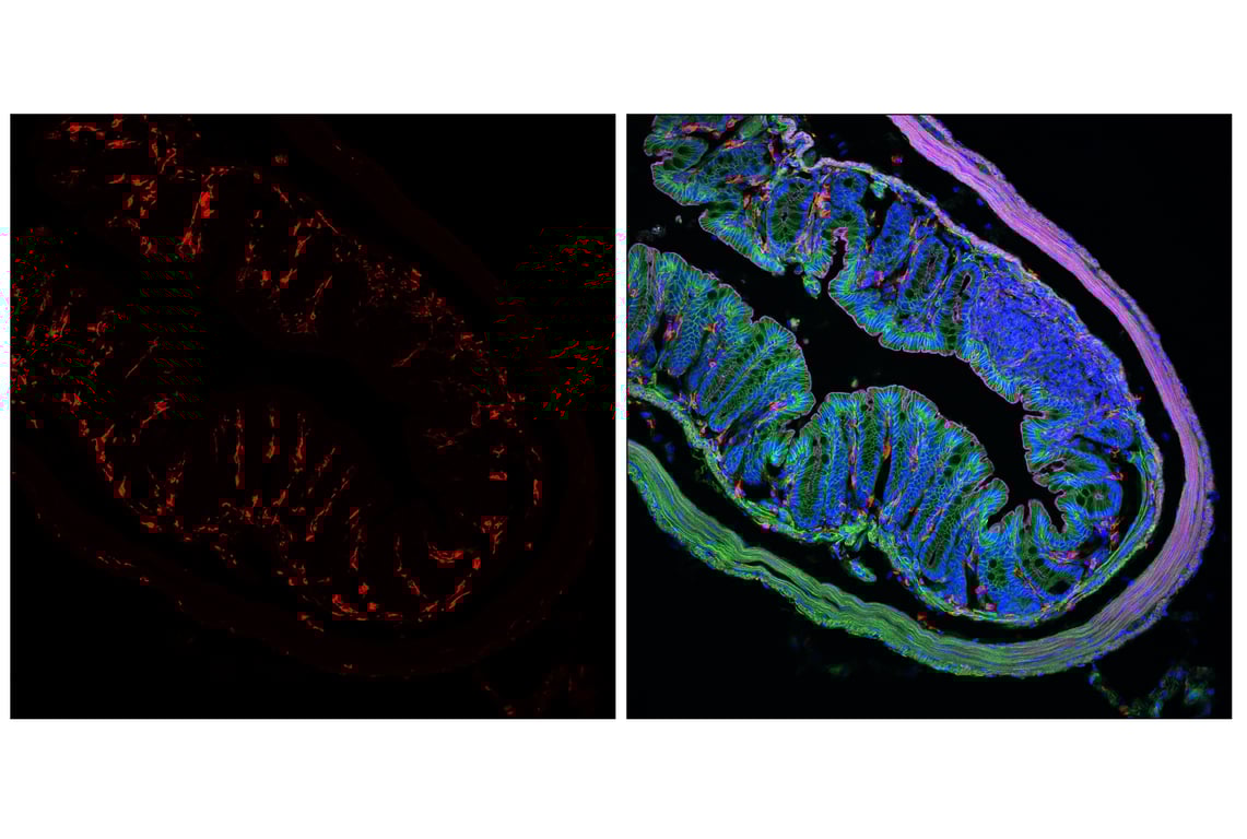 Cytotoxin / Radiophobia【輸入盤】 ZAP-X Gyroscopic Radiosurgery Platform Set to Revolutionize